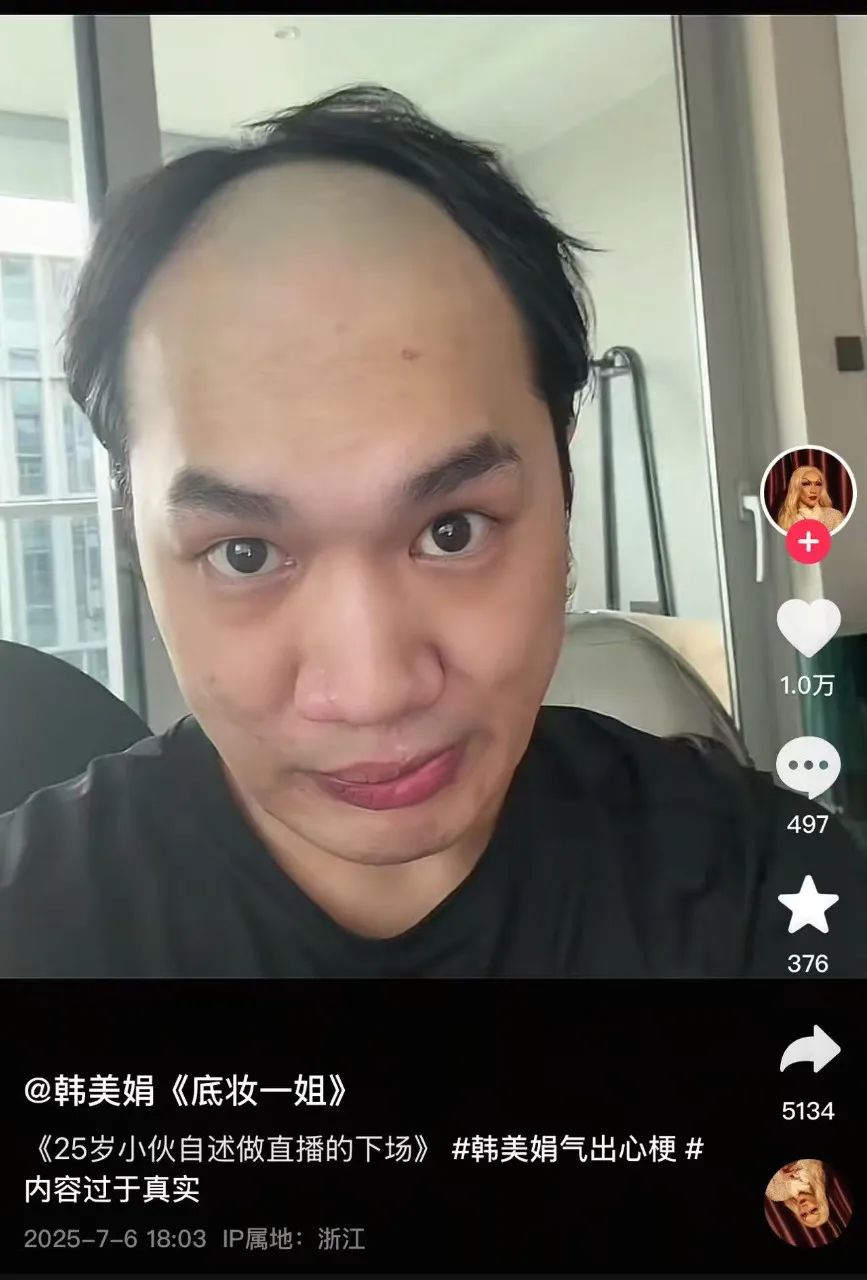 900万粉丝网红韩美娟，自曝25岁就秃头了，并说是做直播的下场！他是怎么走红的？