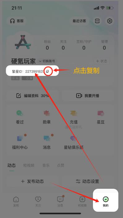 酷狗星币充值中心,苹果用户专属酷狗币优惠充值指南